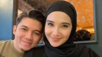 Zaskia Sungkar Semangat Jalani Program Bayi Tabung Meski Harus Menahan Diri dari Hobi Berkuda