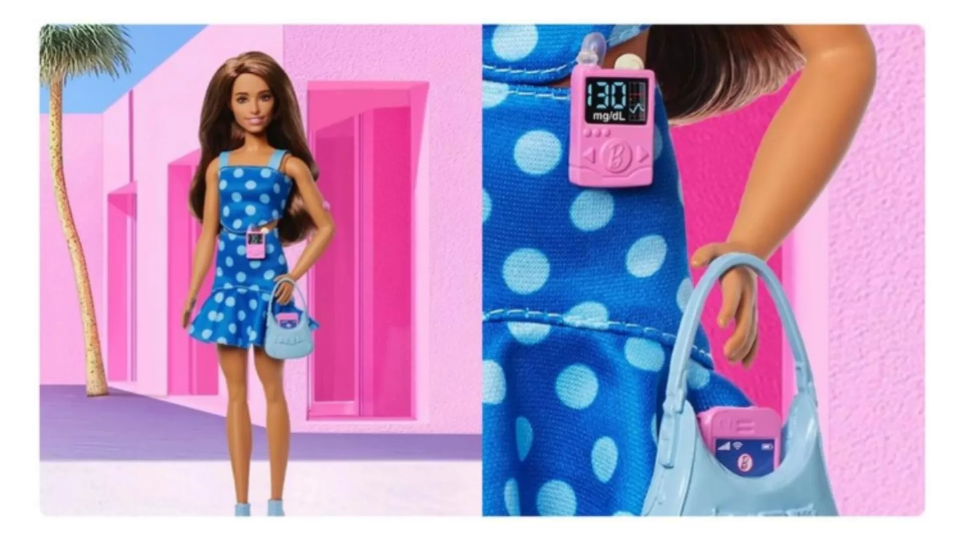 Boneka Barbie Edisi Diabetes Tipe 1 Dengan Pompa Insulin Pink Dan Monitor Glukosa Di Lengannya