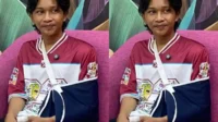 Fajar Sadboy Cedera Tulang Retak dan Kuku Copot Usai Kecelakaan Motor di Jakarta Timur Fajar Sadboy Cedera Tulang Retak Dan Kuku Copot Usai Kecelakaan Motor Di Jakarta Timur