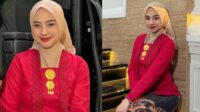 Ria Ricis Akui Oplas Hidung Berawal dari Masalah Kesehatan Ria Ricis Akui Oplas Hidung Berawal Dari Masalah Kesehatan