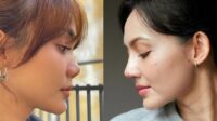 Rina Nose Ungkap Post-Op Blues Pasca Rhinoplasty Rina Nose Ungkap Post Op Blues Pasca Rhinoplasty